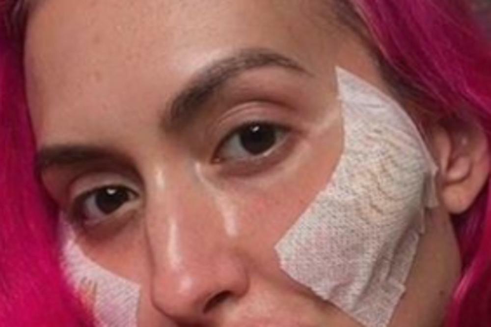 ANASTASIJA UNAKAZILA SVOJE LICE, IZOBLIČILA SE CELA, JEZIVA JE: Užasno, pogledajte NA ŠTA LIČI, OPERACIJA PROPALA