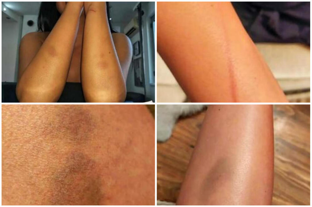 "JE**O TE DAN KAD SI SE RODILA, BOLJE DA SI UMRLA": Otac brutalno maltretirao ćerku, morala je da pobegne! (FOTO)