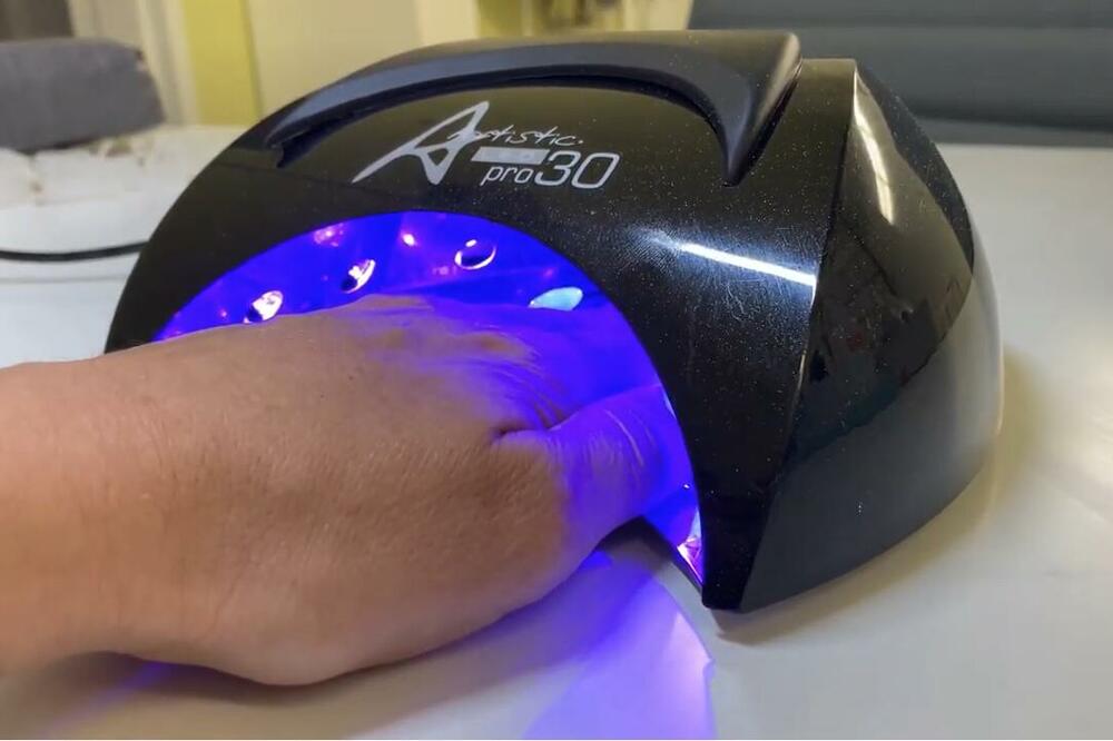 SRPKINJE MASOVNO STAVLJAJU GEL LAK, A NISU SVESNE KOLIKO JE OPASAN: Lekari otkrili da može doći do KOMPLIKACIJA