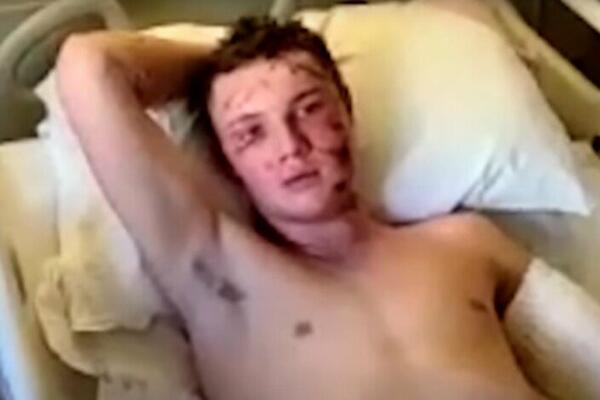 "MOGAO SAM DA ČUJEM KAKO ZUBI UDARAJU O MOJU LOBANJU": Studenti jedva preživeli HOROR, napala ih OPAKA ZVERKA!