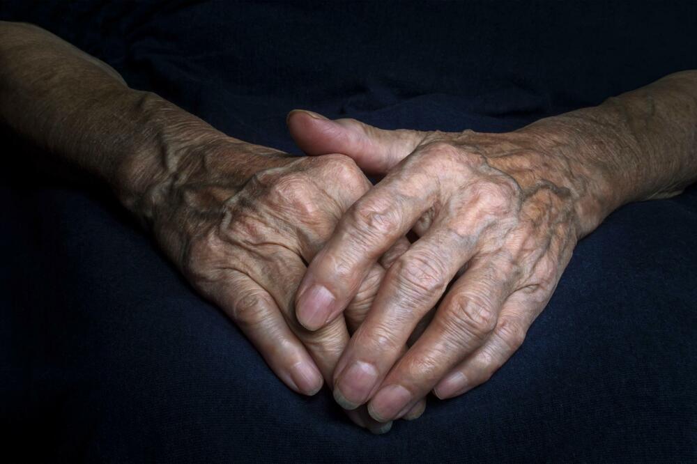 SKINITE STARAČKE PEGE PRIRODNOM MEŠAVINOM U KOJU SE ŽENE KUNU: Povratite vašim rukama MLADALAČKI IZGLED