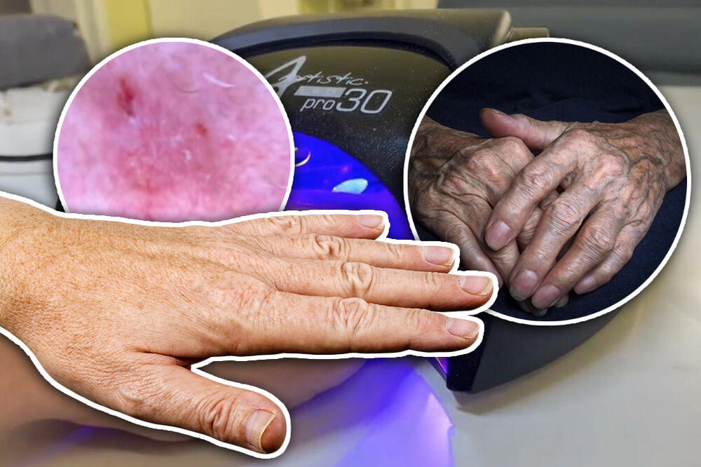 ESTETSKI LEKAR OTKRIO SVE RIZIKE MANIKIRA, JEDAN MOŽE DA BUDE KOBAN PO VAS! Žene u Srbiji, ovo MORAJU DA ZNAJU