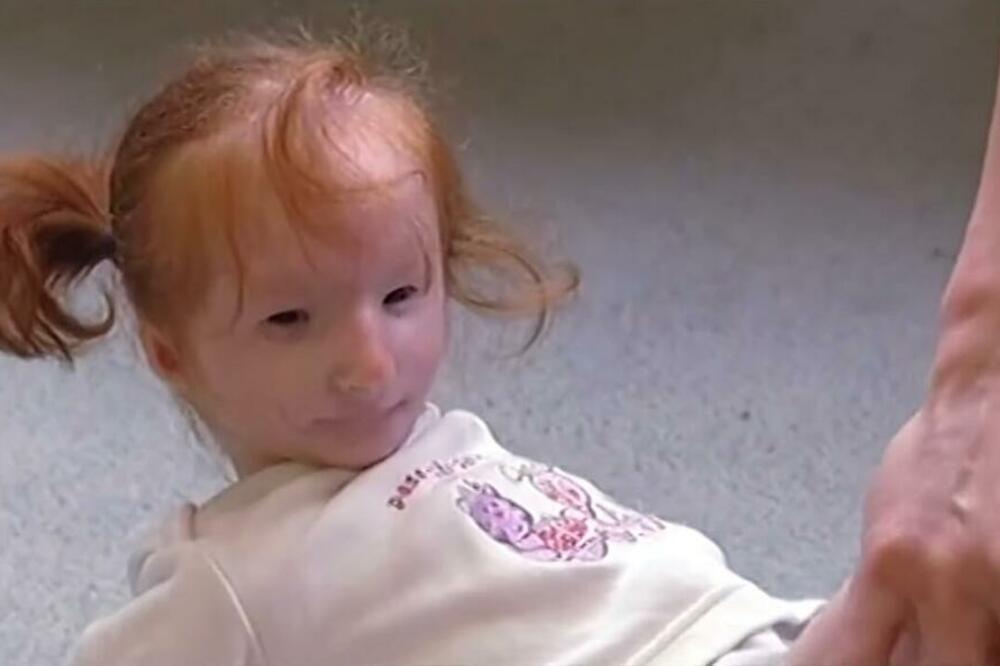 OVOM ANĐELČIĆU SU PREDVIĐALI DA ĆE DA ŽIVI SAMO GODINU DANA: Ovako sada izgleda NAJMANJA DEVOJČICA NA SVETU! VIDEO