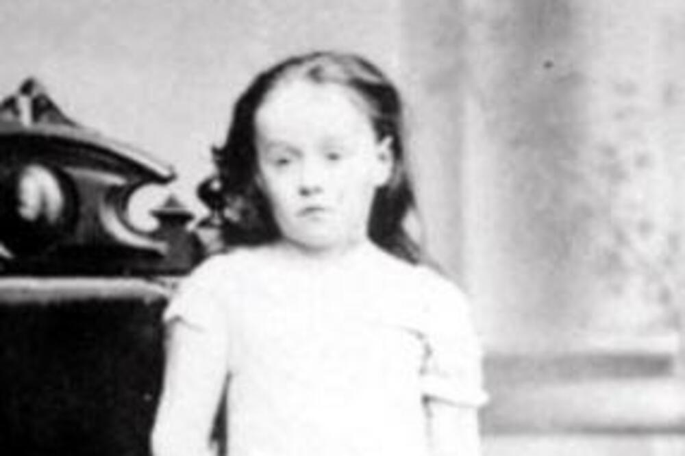 DEVOJČICA SA SLIKE JE PREŽIVELA TOLIKI HOROR DA ĆETE SE NAJEŽITI OD GLAVE DO PETE: Na levoj strani ČELA je imala...