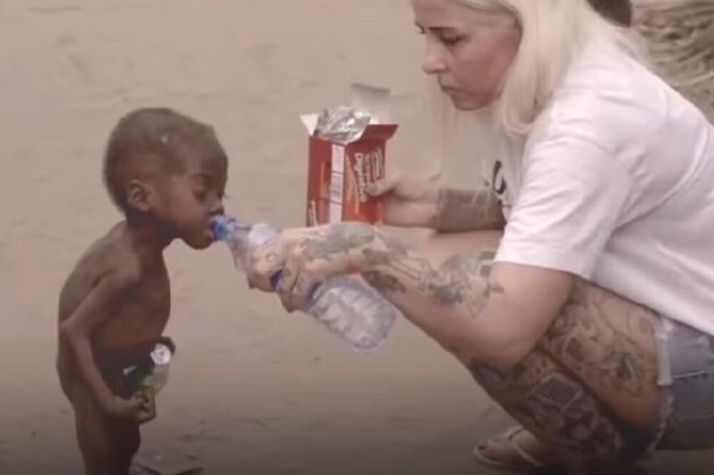 EVO KAKO DANAS IZGLEDA DEČAK SA JEDNE OD NAJPOTRESNIJIH FOTOGRAFIJA IKADA: Roditelji ga ostavili da UMRE! (FOTO)