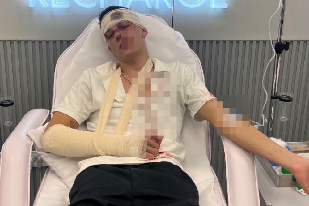 JUTJUBER LAŽIRAO DA SU GA PRETUKLI: Evo ŠTA SE KRIJE iza svega