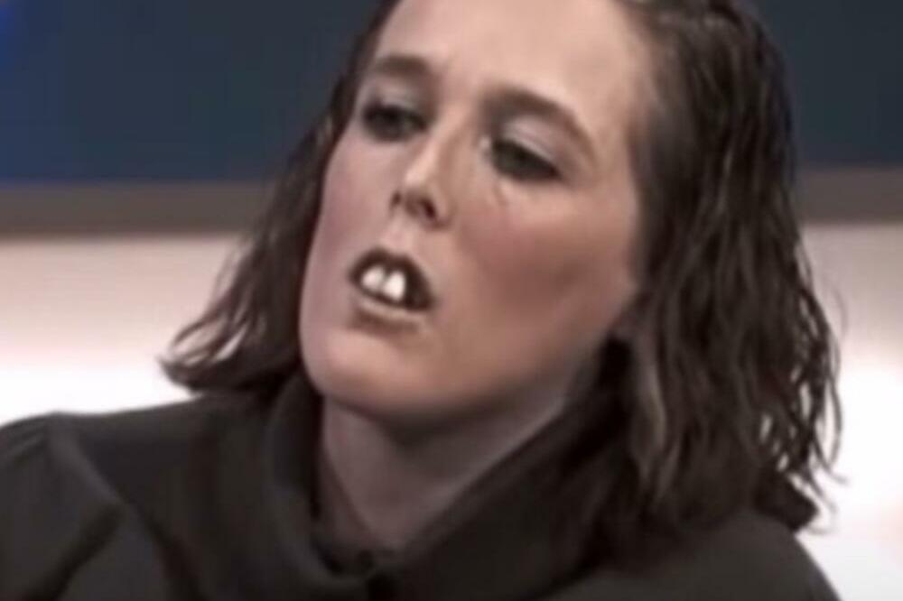 NIKO NE VERUJE DA JE NA SLICI ISTA OSOBA: Zvali su je "ŽENA SA KONJSKIM ZUBIMA", a onda je usledio ŠOKANTAN OBRT