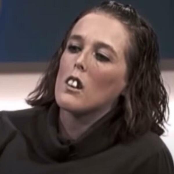 NIKO NE VERUJE DA JE NA SLICI ISTA OSOBA: Zvali su je "ŽENA SA KONJSKIM ZUBIMA", a onda je usledio ŠOKANTAN OBRT