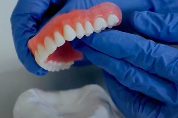 MARIJA KRENULA NA SPAVANJE SA PROTEZOM I NIJE SE PROBUDILA: Napori lekari bili UZALUDNI, ovo svima može da se DESI