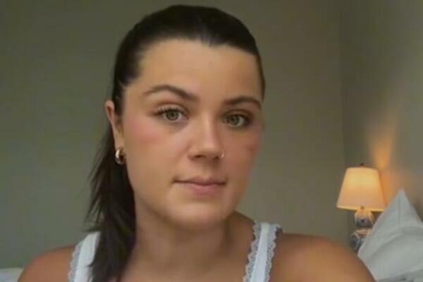 AKO OVO RADITE SA SVOJIM TELOM, NARUŠAVATE ZDRAVLJE! Nutricionisti zgranuti ovim trendom, UNIŠTAVATE SE!