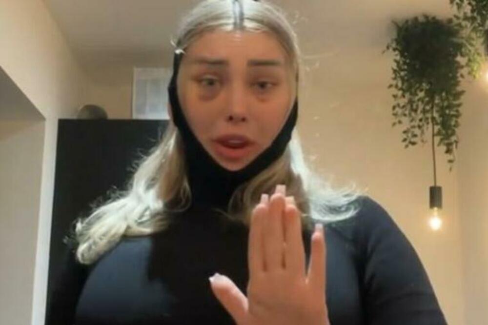 SRPKINJE LUDE ZA OVOM ESTETSKOM KOREKCIJOM, A NJOJ JE EKSPLODIRALA GLAVA: Ova priča će vas naježiti (VIDEO)