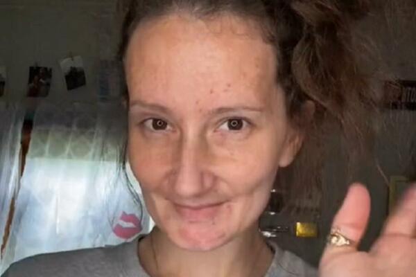 ISPALI SU JOJ SVI ZUBI, PLAŠILA SE DA ĆE JE MUŽ OSTAVITI: Usledila je PROMENA koja je zaludela sve MUŠKARCE (VIDEO)