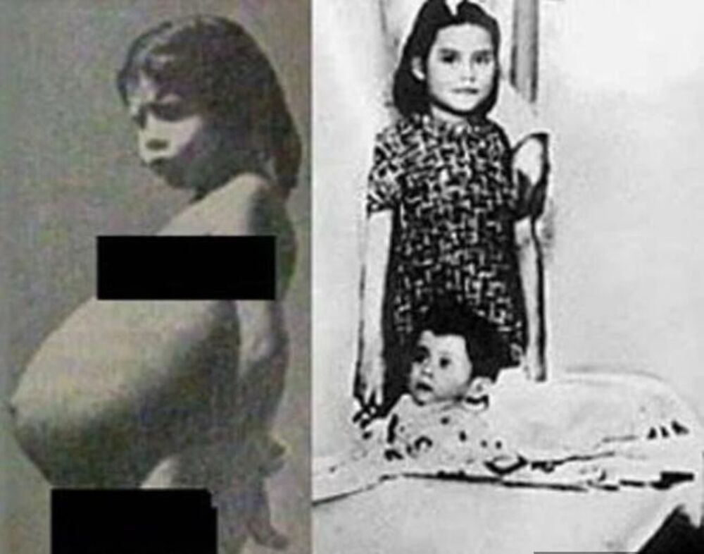 Lina Medina