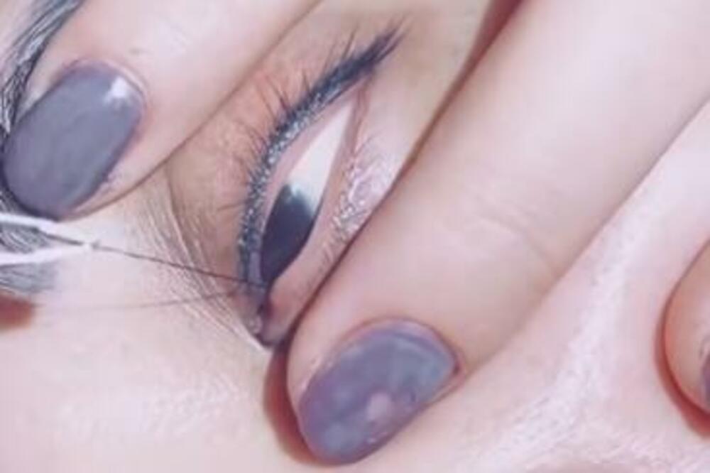 IMALA JE URASLU DLAKU U OKU: Kada su je izvukli, bili su SKAMENJENI zbog onog što vide