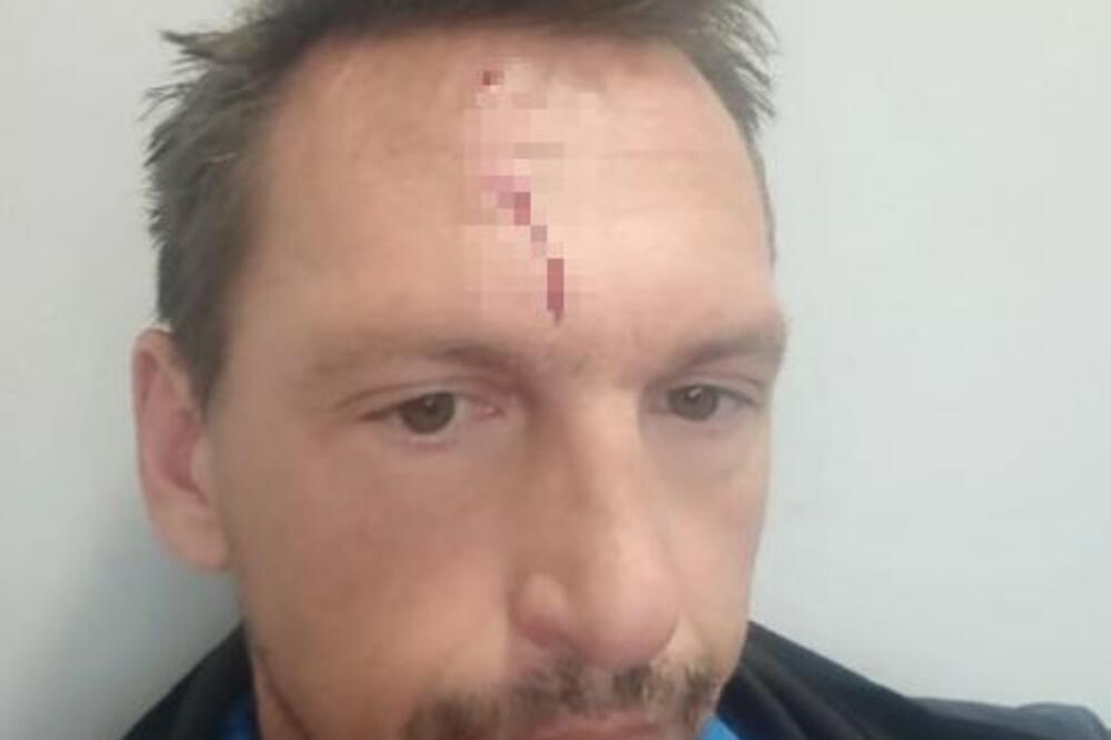 NEVIĐENI SKANDAL U SRPSKOM SPORTU! Napadnut trener Partizana - tvrdi da mu je čelnik Zvezde razbio glavu! FOTO