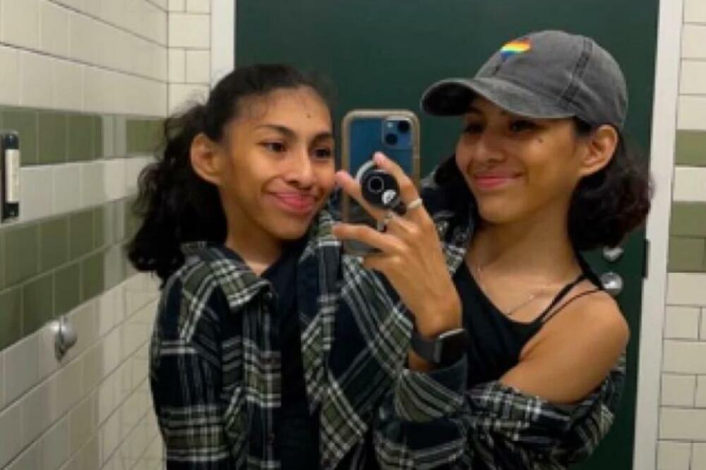 SIJAMSKE BLIZNAKINJE PROGOVORILE O LJUBAVNOM ŽIVOTU: Žive u JEDNOM telu, a razdvajanje bi moglo značiti SMRT! FOTO