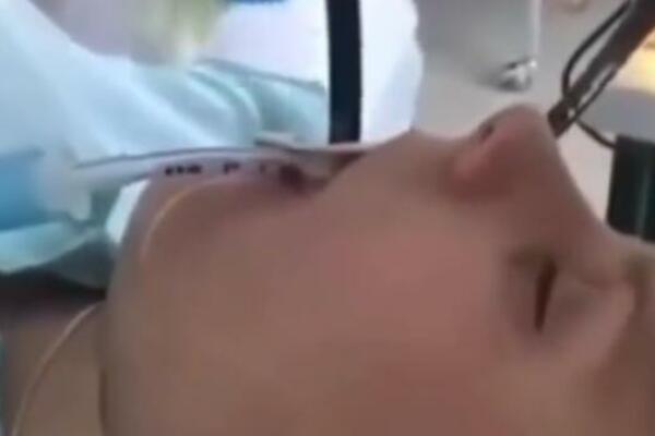 DA LI MOŽETE DA IZDRŽITE 11 SEKUNDI KOMPLETNOG HORORA? Kad vidite šta su joj izvukli iz usta SABLASNUĆETE SE! VIDEO