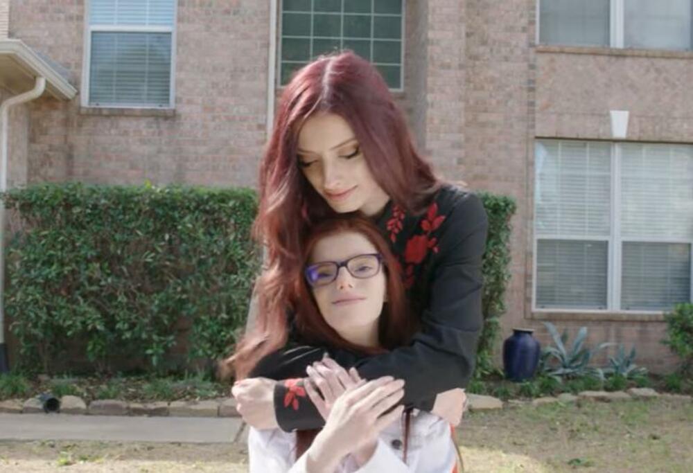 Jednojajčane bliznakinje