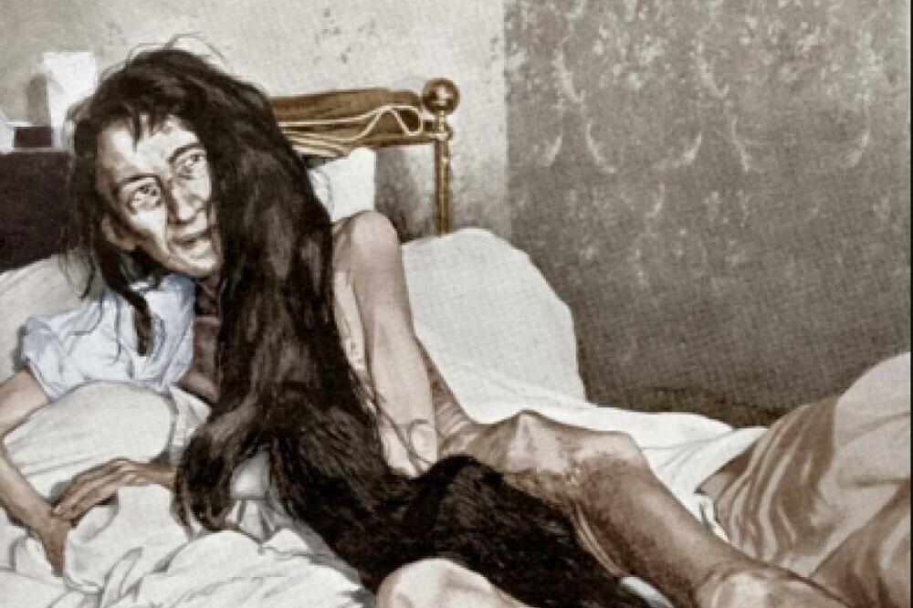 MAJKA JE DRŽALA NA TAVANU 25 GODINA I OSTAVILA DA SE GUŠI U IZMETU: Doživela je sudbinu STRAŠNIJU OD HOROR FILMA