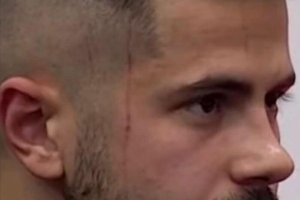 BILAL BRAJLOVIĆ SAV U OŽILJCIMA I KONCIMA, MAJA BI PLAKALA DA VIDI RANE: Fotografije nisu za one sa SLABIM STOMAKOM