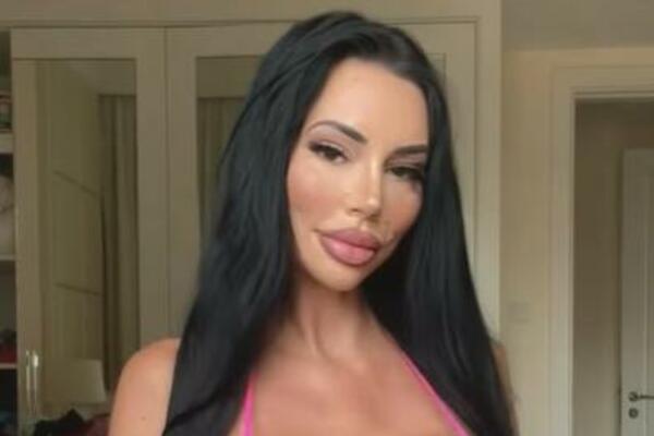 KAO TINEJDŽERKU ZVALI SU JE "DASKA": Sada izgleda kao MILION DOLARA, niko ne može da JE PREPOZNA (FOTO)