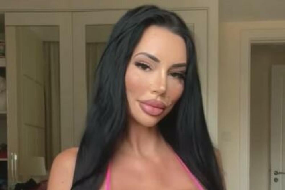 KAO TINEJDŽERKU ZVALI SU JE "DASKA": Sada izgleda kao MILION DOLARA, niko ne može da JE PREPOZNA (FOTO)