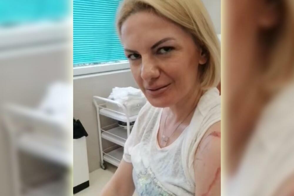PEVAČICA ZADOBILA OPEKOTINE PRVOG STEPENA: Pratioci ZABEZEKNUTI jezivim prizorom, sve snimila VIDEO