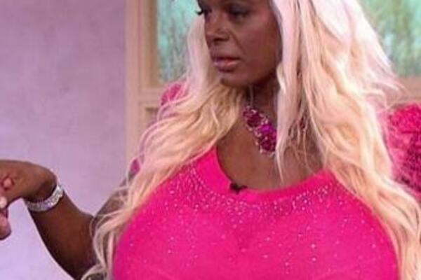 POTROŠILA JE 50.000 EURA DA BI BILA CRNKINJA: Kada vidite kako je izgledala pre, pitaćete se ŠTA JE S NJOM? (FOTO)