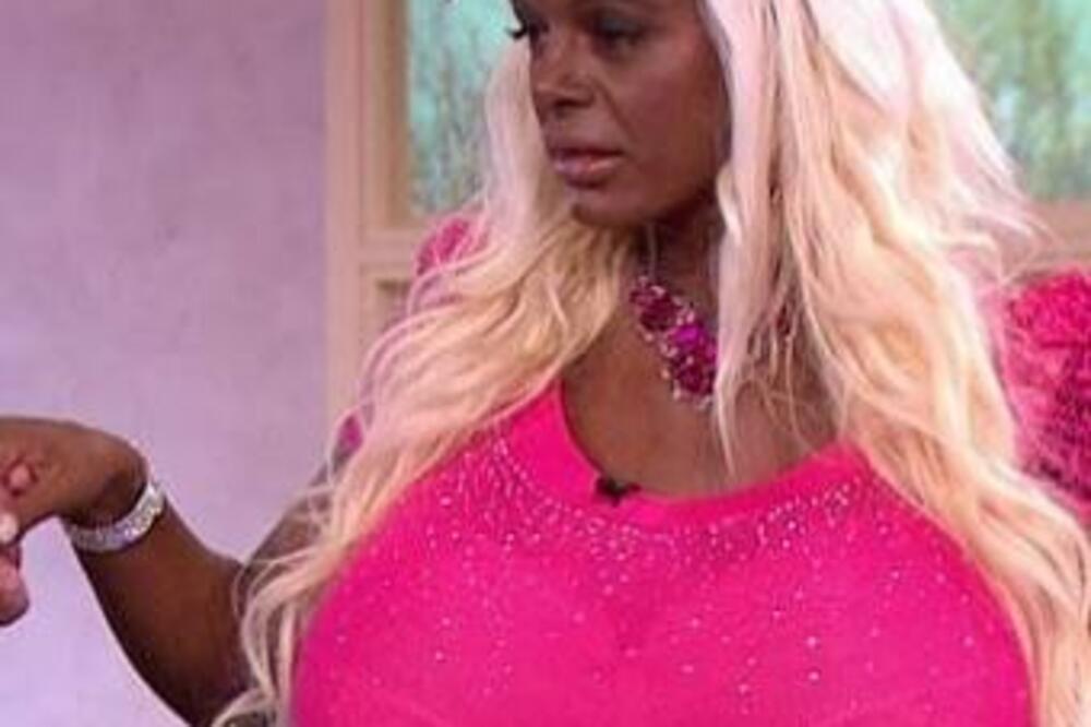 POTROŠILA JE 50.000 EURA DA BI BILA CRNKINJA: Kada vidite kako je izgledala pre, pitaćete se ŠTA JE S NJOM? (FOTO)