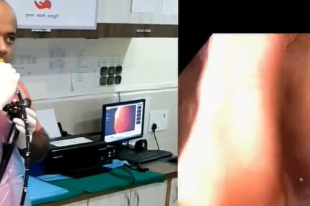 DOKTOR SAM SEBI URADIO GASTROSKOPIJU: Za gledanje OVOGA trebaće vam JAK ŽELUDAC (VIDEO)