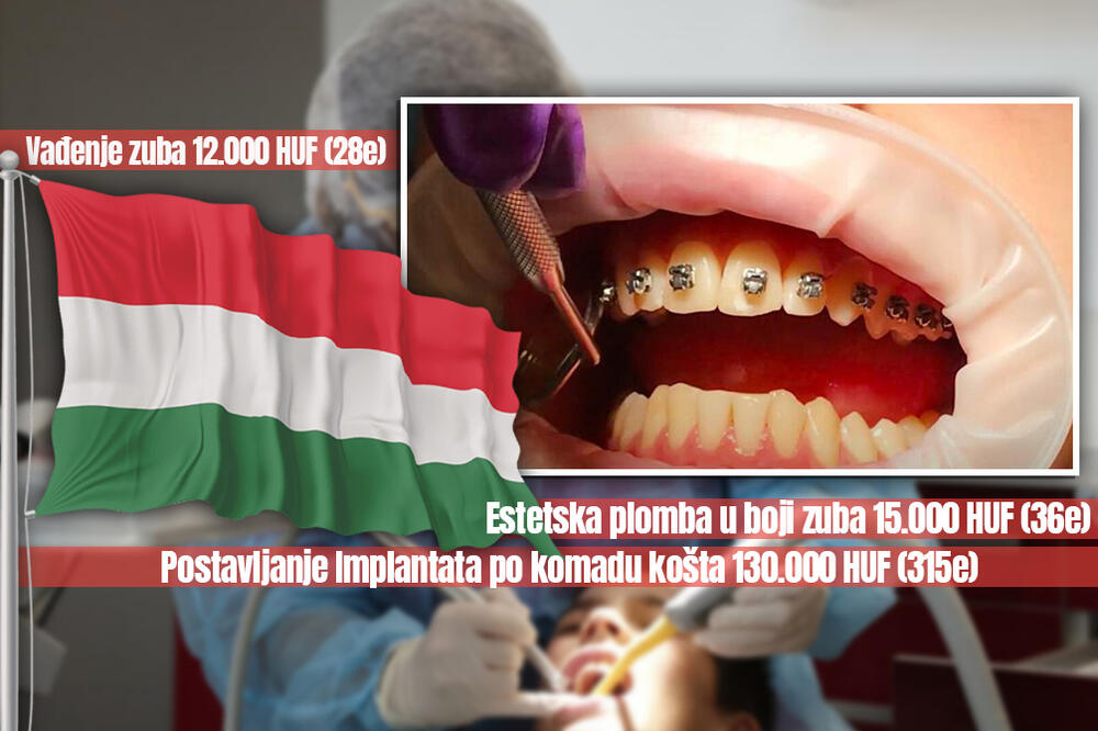 CENE ZUBARA U MAĐARSKOJ POTPUNO DRUGAČIJE NEGO KOD NAS: Proverili smo cifre i iznenadili se velikom razlikom!