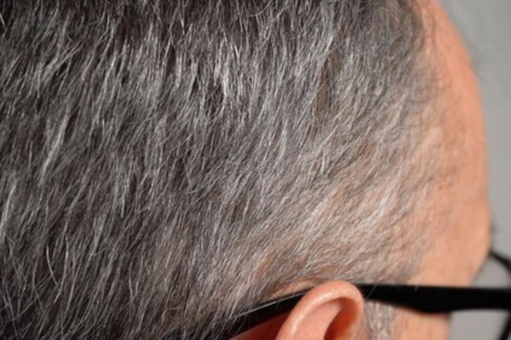 EVO KAKO DA PREKRIJETE SEDE BEZ FARBE: Nema HEMIJE samo vam treba ova 1 stvar iz KUHINJE koju mogu SVI da koriste