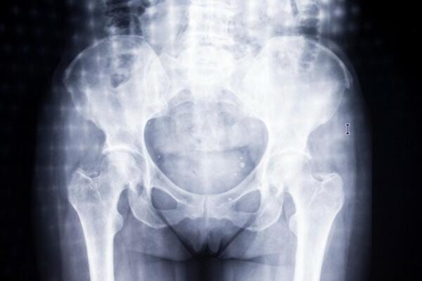 ŽENE KOJE NE JEDU MESO SU U RIZIKU OD OVOGA: Naučnici došli do ZASTRAŠUJUĆEG SAZNANJA