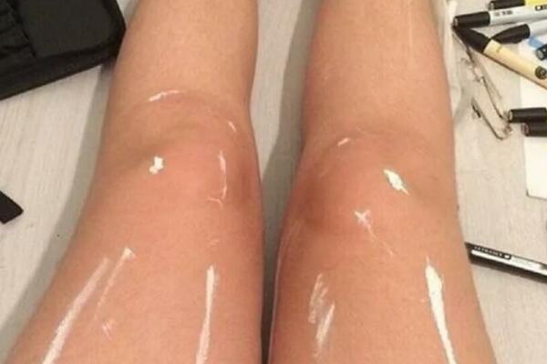 SVI MISLE DA SU NA SLICI NAULJANE ŽENSKE NOGE: Kada čuju ISTINU, momentalno OSTANU BEZ TEKSTA (FOTO)