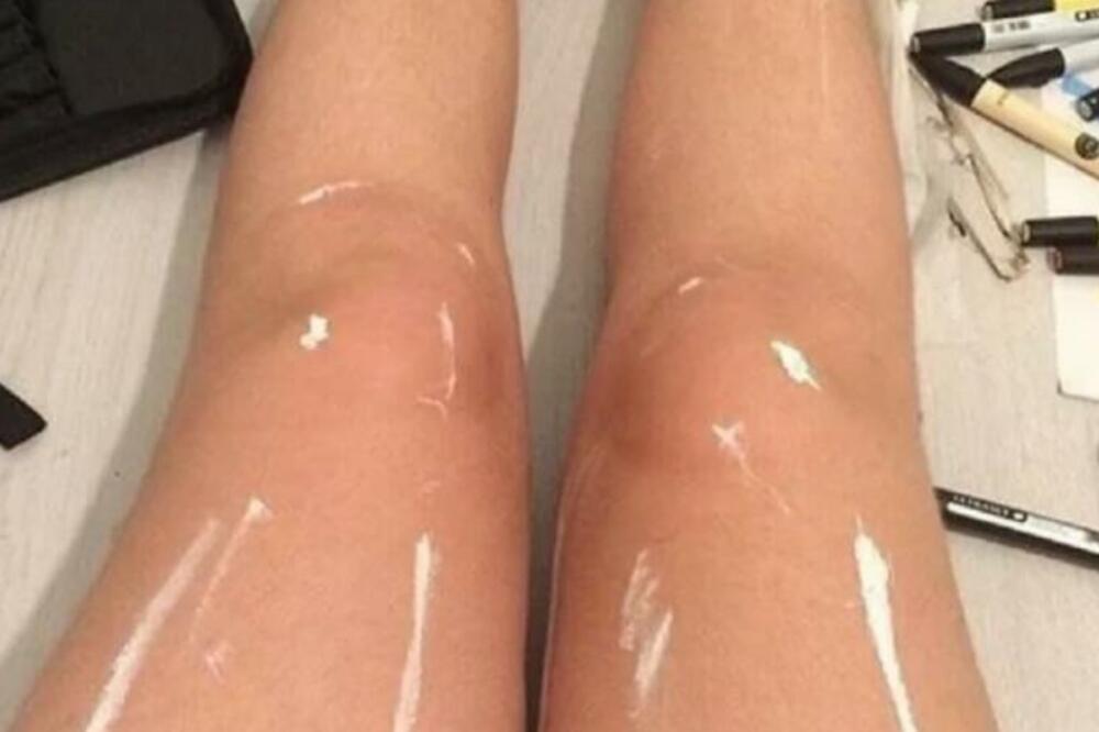 SVI MISLE DA SU NA SLICI NAULJANE ŽENSKE NOGE: Kada čuju ISTINU, momentalno OSTANU BEZ TEKSTA (FOTO)