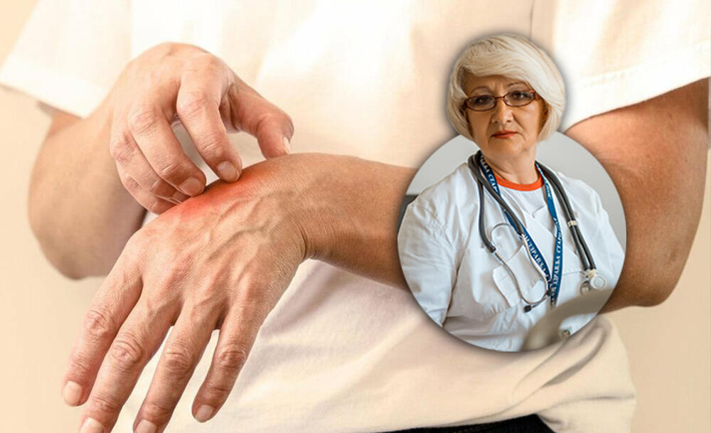 Dr Biserka Obradović, Alergija