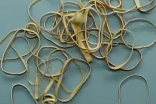 OD SADA VIŠE NEĆETE BACATI GUMICE ZA TEGLE: Imaju široku primenu u kući i od velike su pomoći SVIM DOMAĆICAMA