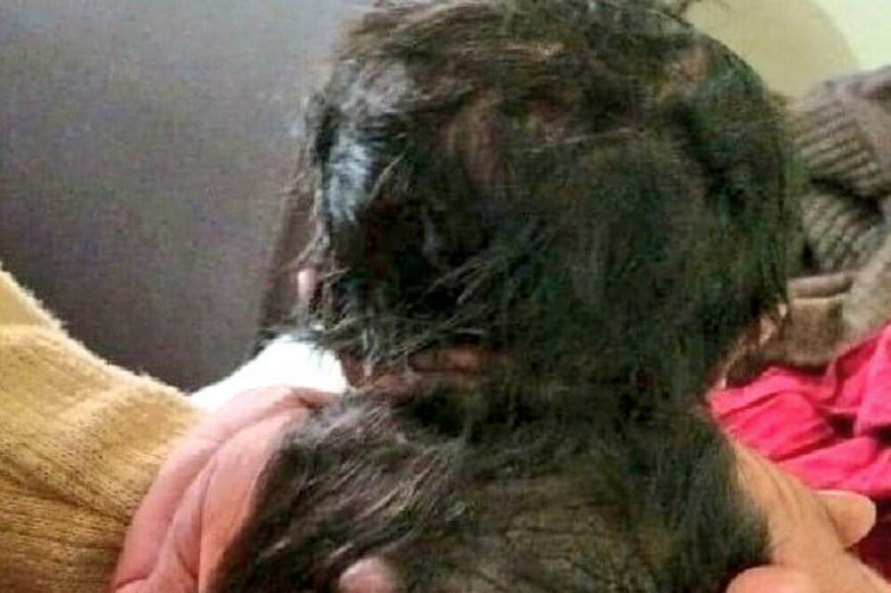 IZ PORODILJE IZVUKLI "CRNU MASU": Lekar za 22 godine rada NIJE VIDEO OVAKAV SLUČAJ! (FOTO)