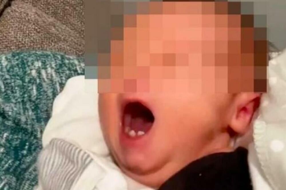 ŠTA JE, BRE, OVO? Beba šokirala SVE ODREDA, lekari na porođaju ZANEMELI, ovo niko nije OČEKIVAO (VIDEO)