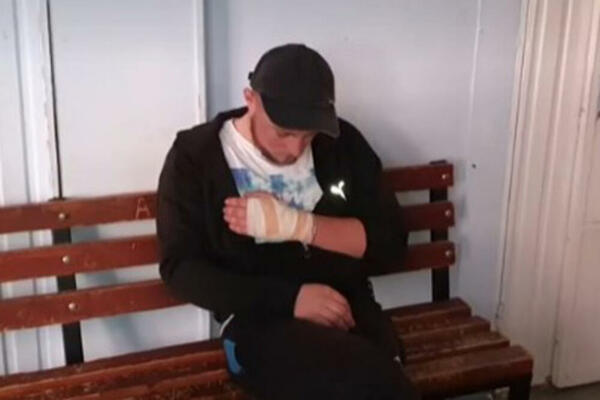 MILOŠU IZVADILI METAK IZ ŠAKE: Oglasio se otac mladića (21) koji je upucan sa rođakom (11) kod Štrpca