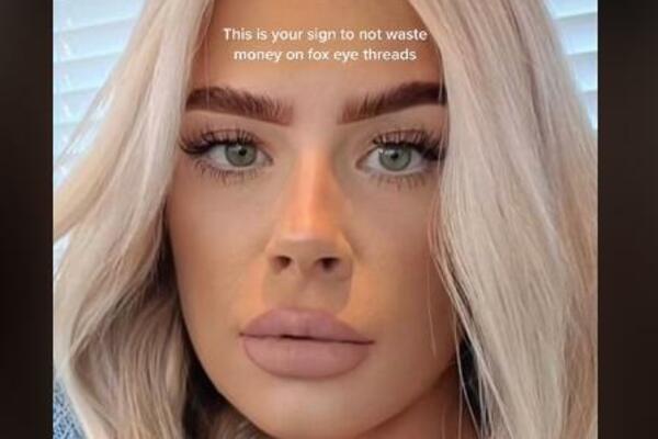 URADILA POPULARNI BJUTI TREND PA SE GRDNO POKAJALA: Samo sam KINULA i sve je propalo - UNAKAŽENA SAM! (VIDEO)