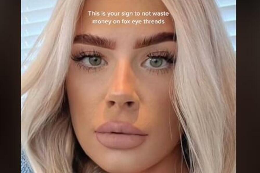 URADILA POPULARNI BJUTI TREND PA SE GRDNO POKAJALA: Samo sam KINULA i sve je propalo - UNAKAŽENA SAM! (VIDEO)