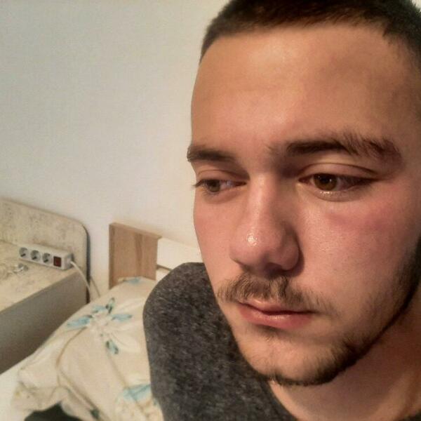 JOŠ JEDAN NAPAD NA SRBE NA KOSOVU: Grupa Albanaca pretukla mladića kada se vraćao sa Božićne liturgije