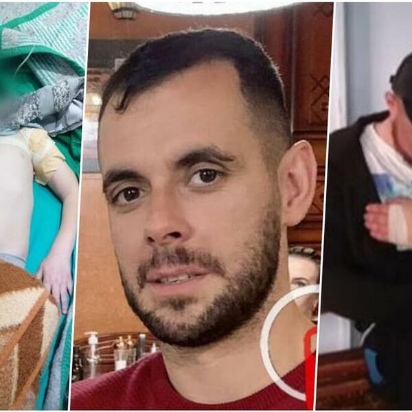 POZNATO KAKVO JE STANJE STEFANA I MILOŠA KOJE JE RANIO ALBANAC: Jedan će verovatno morati DUŽE da ostane u bolnici