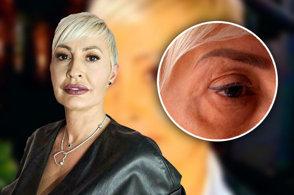 MALOLETNIK ME JE UDARAO USRED BOLNICE, HTEO JE DA ME UBIJE: Medicinska sestra Aleksandra o nasilju koje je doživela