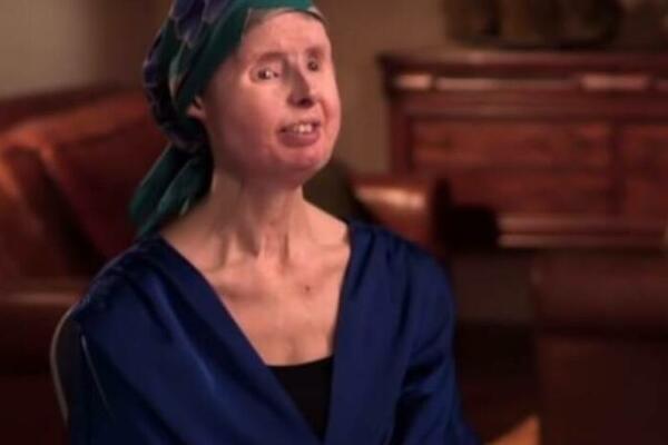 "UBIJA JE, RASTAVLJA JE NA DELOVE": Ovo je NAJJEZIVIJI poziv policiji, žena ostala bez RUKU, NOSA I OČIJU (VIDEO)