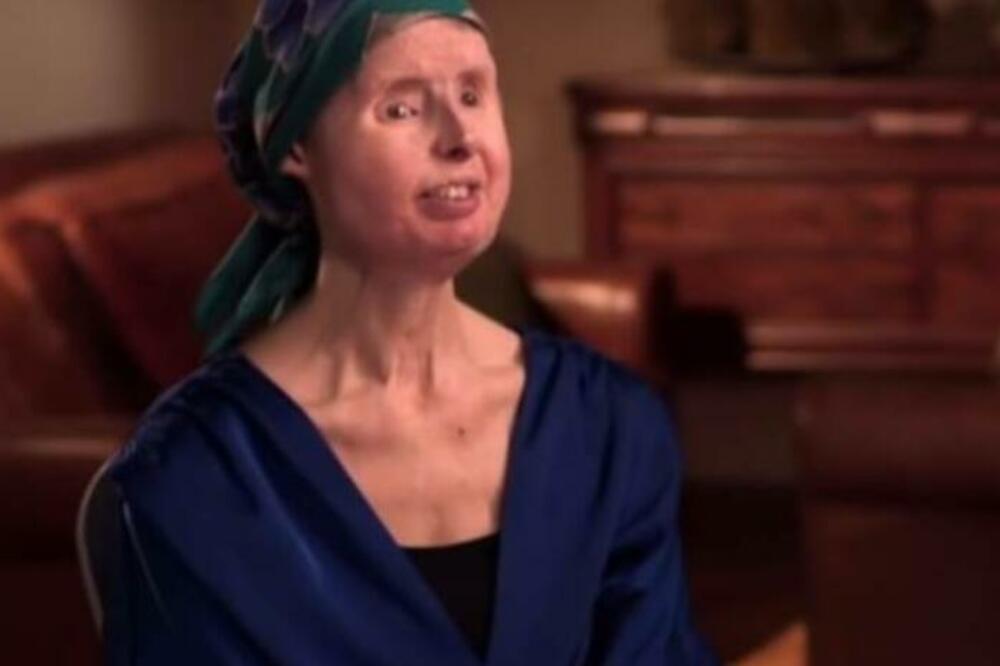 "UBIJA JE, RASTAVLJA JE NA DELOVE": Ovo je NAJJEZIVIJI poziv policiji, žena ostala bez RUKU, NOSA I OČIJU (VIDEO)