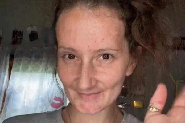 ISPALI SU JOJ SVI ZUBI, PLAŠILA SE DA ĆE JE MUŽ OSTAVITI: Usledila PROMENA koja je zaludela sve MUŠKARCE (VIDEO)