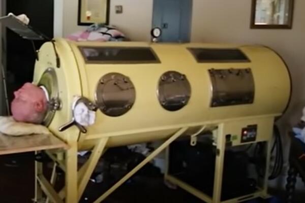 ALEKSANDAR JE VEĆ 7O GODINA U GVOZDENOJ KUTIJI: Bolest koju ima NIJE ISKORENJENA i ČESTA JE KOD DECE! (VIDEO)