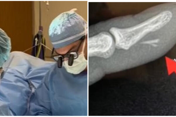 MLADI HIRURG U JAVNOST IZNEO SVE I SVAŠTA: Kači na društvene mreže materijal iz operacione sale